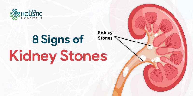 8 Signs of Kidney Stones