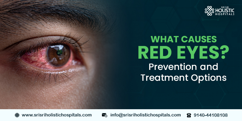 What Causes Red Eyes? Prevention and Treatment Options