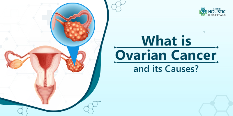 What is Ovarian Cancer and Its Causes?