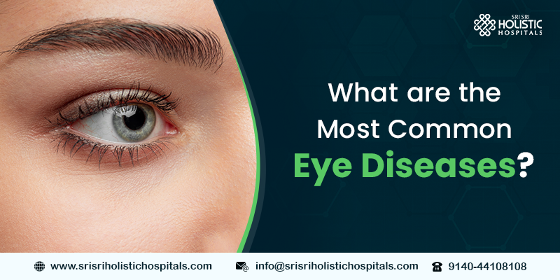 What are the Most Common Eye Diseases?