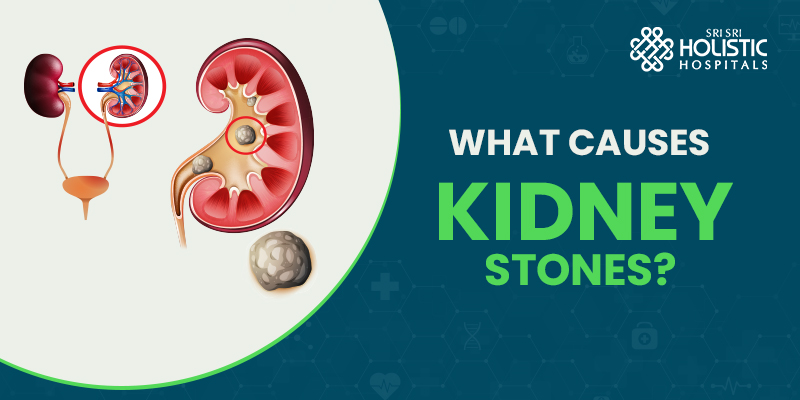 What Causes Kidney Stones?