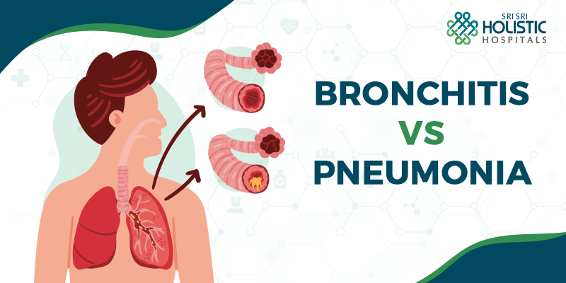 Bronchitis vs. Pneumonia