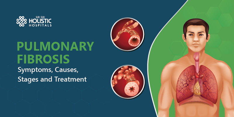 Pulmonary Fibrosis – Symptoms, Causes, Stages and Treatment
