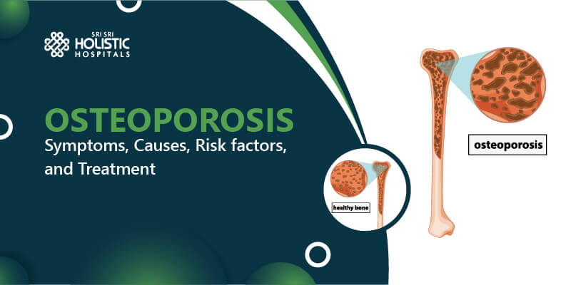 Osteoporosis – Symptoms, Causes, Risk Factors, And Treatment