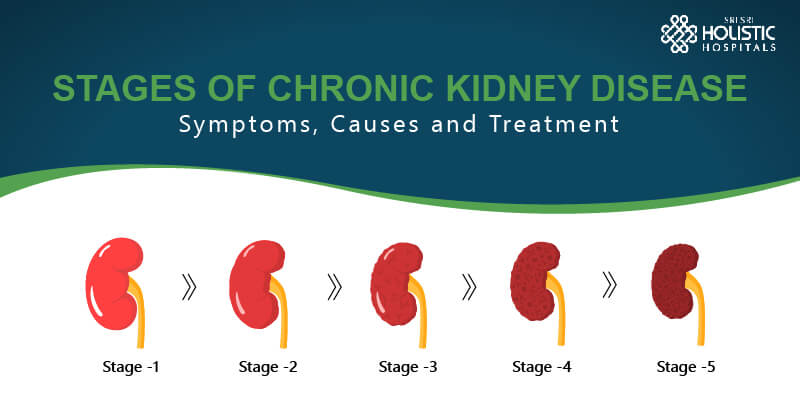 Stages of Chronic Kidney Disease – Symptoms, Causes and Treatment