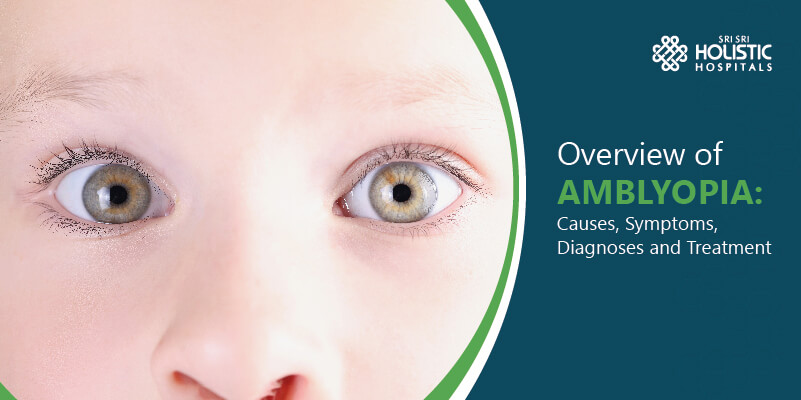 Overview of Amblyopia: Lazy Eye Causes, Symptoms, Diagnoses and Treatment