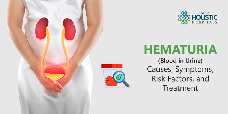 Hematuria (Blood in Urine) – Causes, Symptoms, Risk Factors, and Treatment