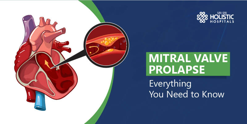 Mitral Valve Prolapse – Everything You Need to Know