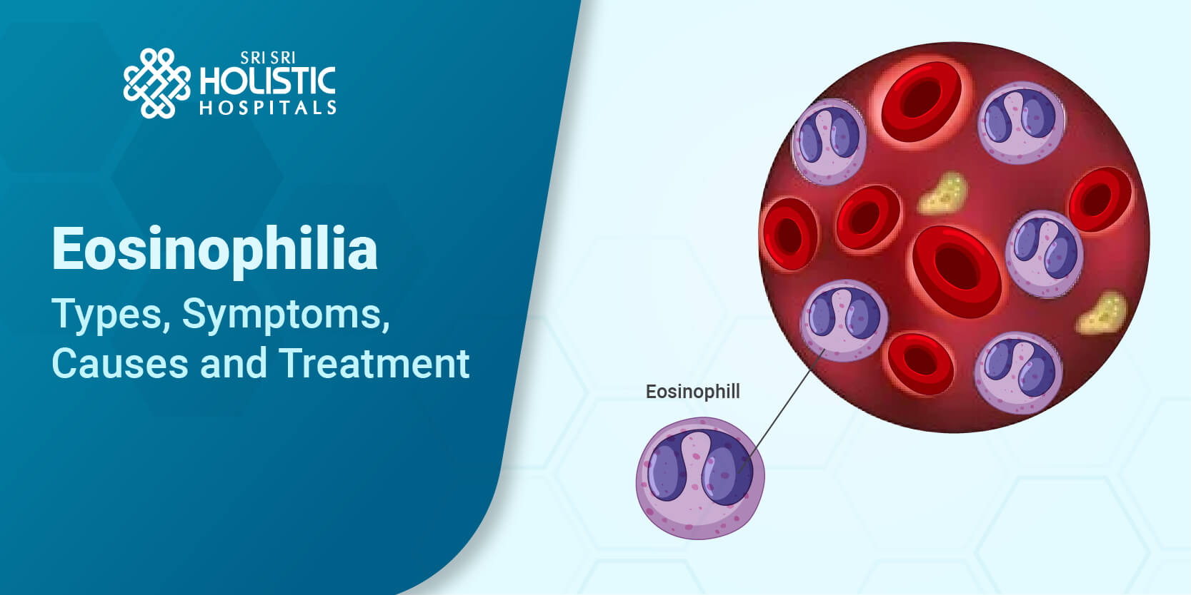 Eosinophilia – Types, Symptoms, Causes, and Treatment