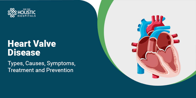 Heart Valve Disease: Types, Causes, Symptoms, Treatment, and Prevention