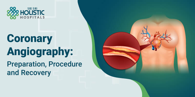 Coronary Angiography: Preparation, Procedure, and Recovery