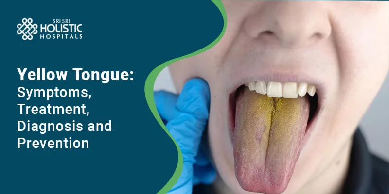 Yellow Tongue: Symptoms, Treatment, Diagnosis, and Prevention