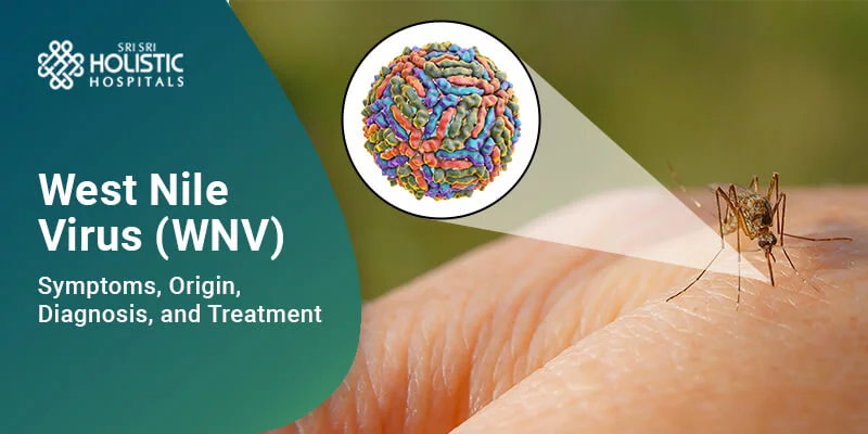 West Nile Virus (WNV) | Origin, Symptoms Diagnosis, and Treatment