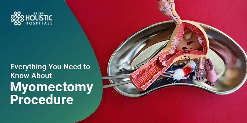 Everything You Need to Know About The Myomectomy Procedure